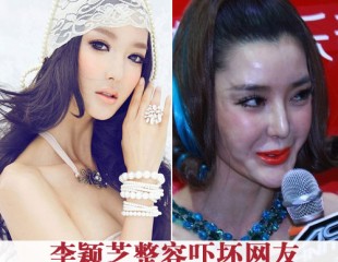 李颖芝整容吓坏网友 整容不是想玩就玩