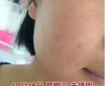 希卡贝尔面膜——女人的投资脸，是怎么做到的？